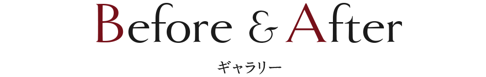 Before&After